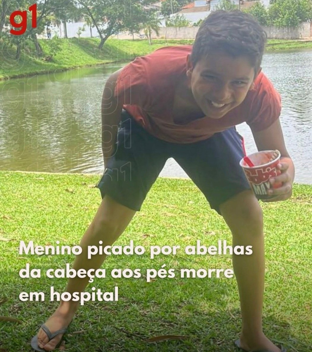 Menino picado por abelhas da cabeça aos pés morre em hospital ! Menino picado por abelhas da cabeça aos pés morre em hospital !